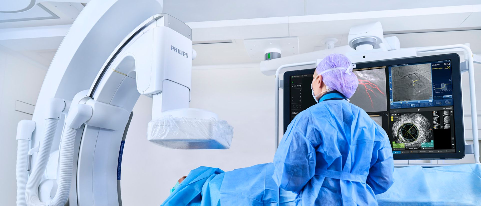 Image guided therapy treatment