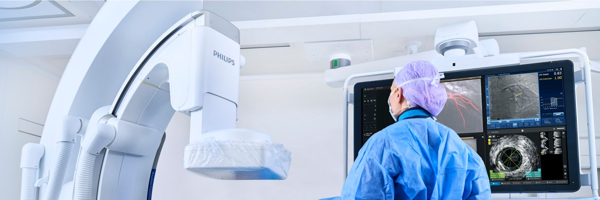 Image guided therapy treatment
