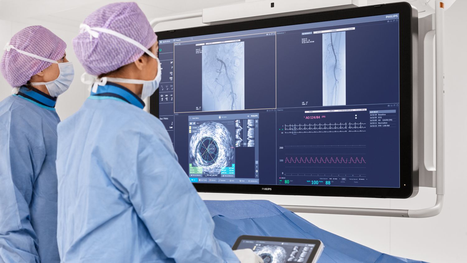 Clinicians looking at screens Philips Azurion