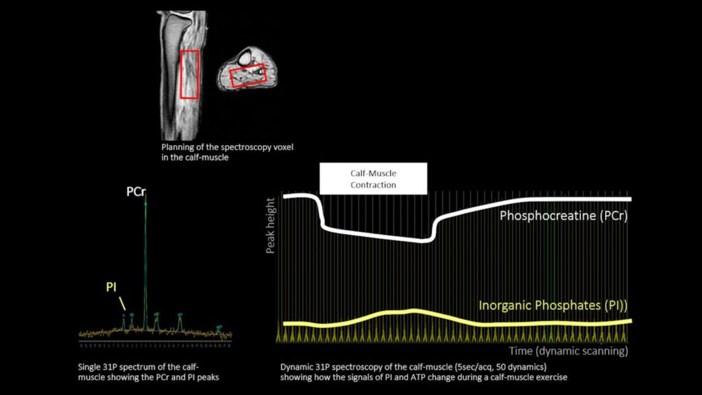 P140 Calf muscle (all dynamics)