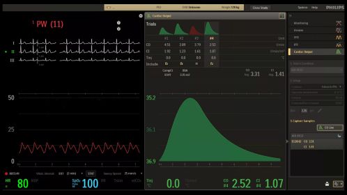 Hemo user interface CardiacOutput control room