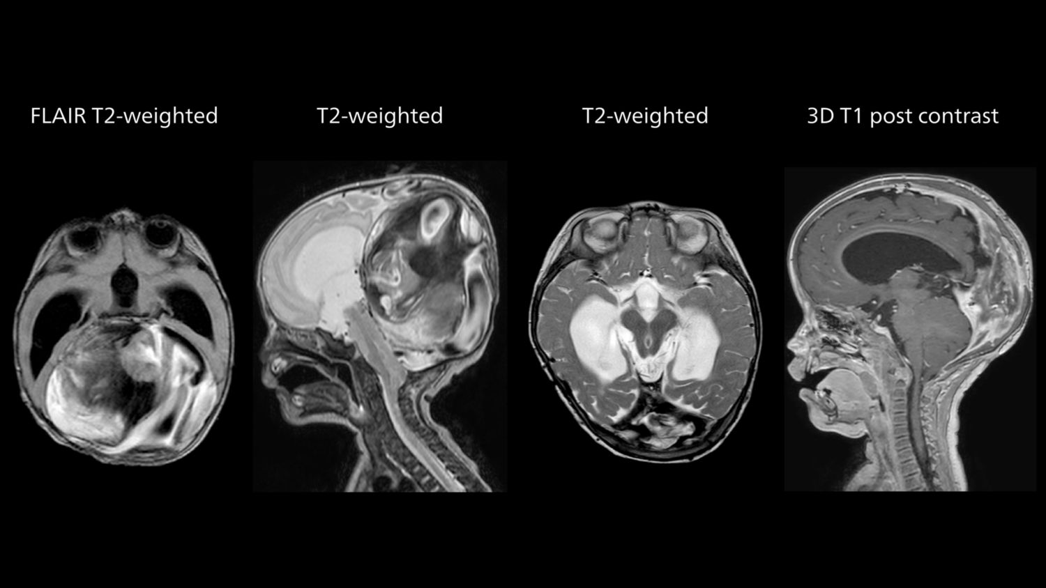 Brain examinations