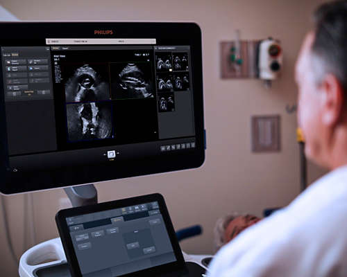 Epiq ultrasound screen