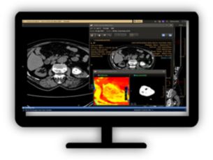 CT Spectral Light Magic Glass​ Review spectral data in a range of not spectral-enhanced CT applications 