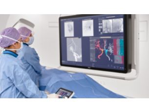 SmartCT Dual Viewer​ 3D volume comparison and fusion solution​