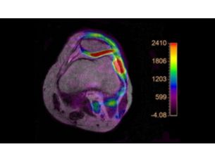 Multi Nuclei - MSK Seamless integration of Multi Nuclei