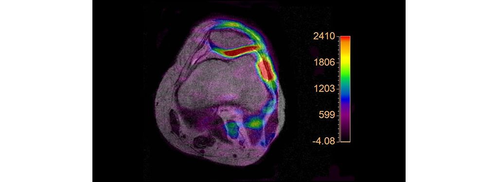 Multi Nuclei MSK