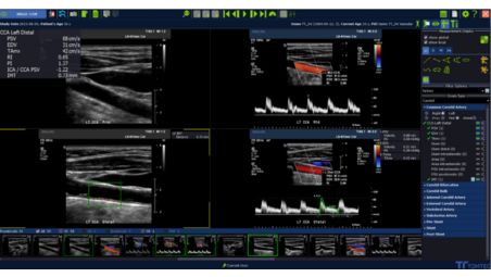 Vascular Routine