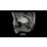 MRCAT Prostate + Auto-Contouring thumbnail
