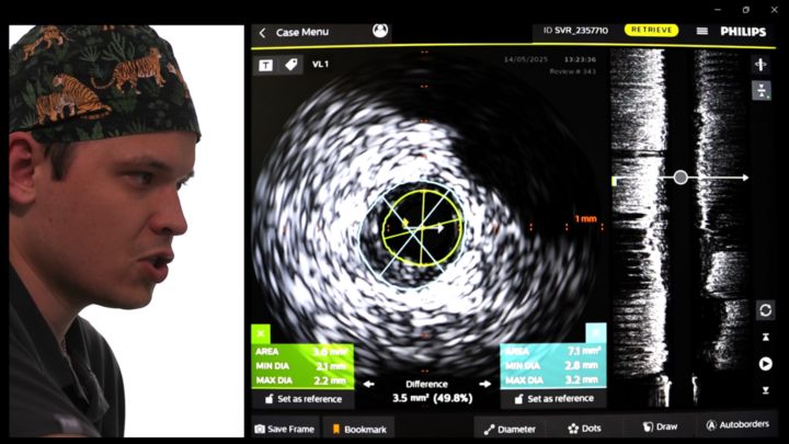 Пошаговое руководство по проведению ВСУЗИ