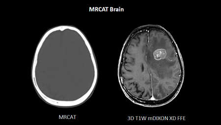 MRCAT Brain