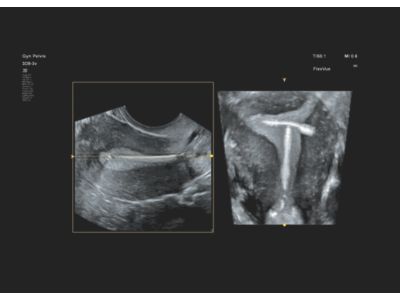 Ultrasound web FlexVue