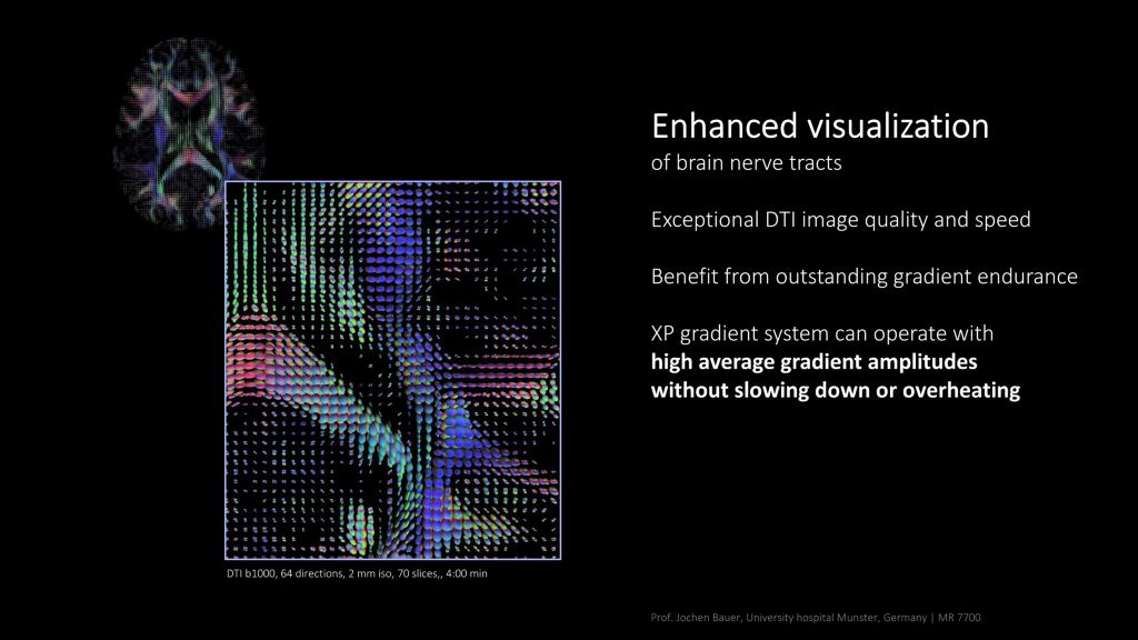 enhanced visualization of brain nerves with MR 7700
