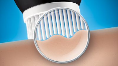 17.000 leistungsstarke Fäden für eine hervorragende Behandlung