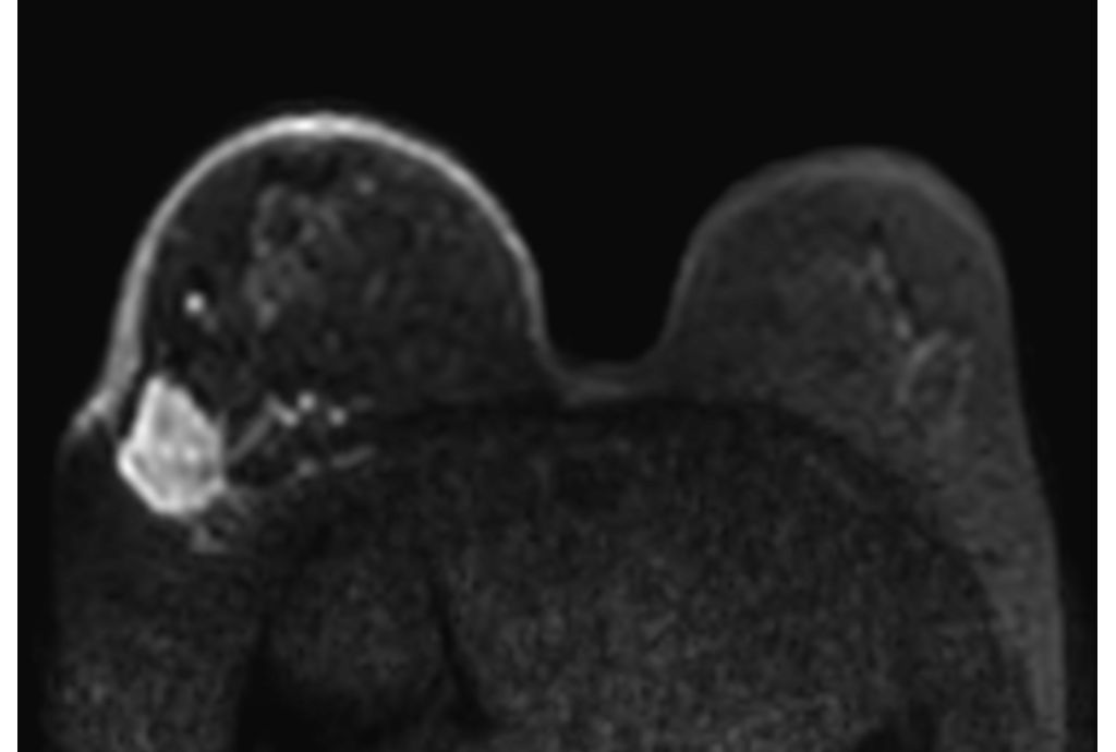 Diffusion (b850)