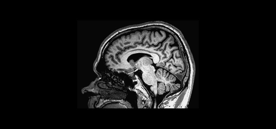 Non-selective 3D T1w TFE

