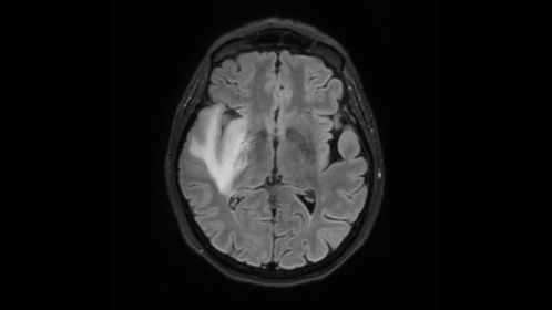 3D BrainVIEW FLAIR