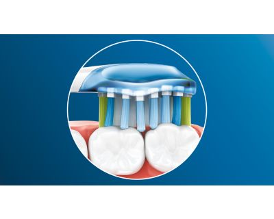 Adaptive cleaning technology