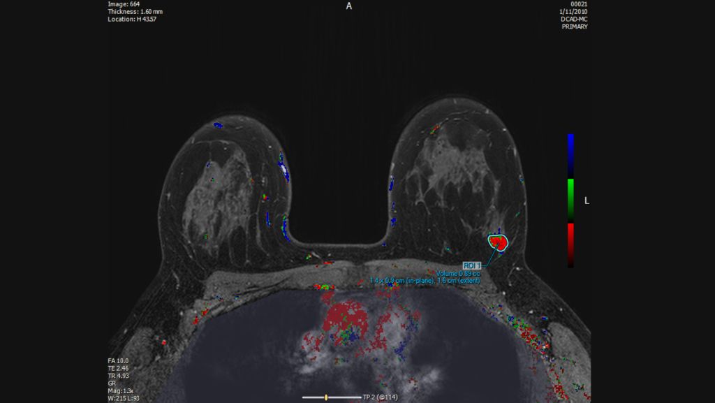 Users can view color overlays based on kinetic characteristics.