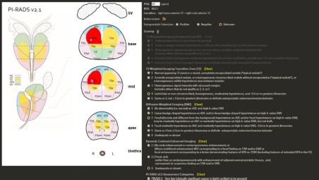 Interactive worksheets summarize study findings