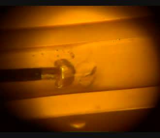 ELCA coronary laser atherectomy catheter producing a vapor bubble in soft gel