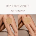 Miniatură a Fotografie beneficiu emoţional