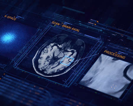 Radiologist sitting behind the MRI console looking at clinical images acquired with Compressed SENSE thumbnail