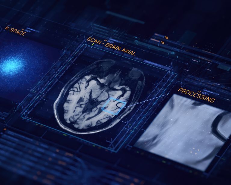 Radiologist sitting behind the MRI console looking at clinical images acquired with Compressed SENSE thumbnail
