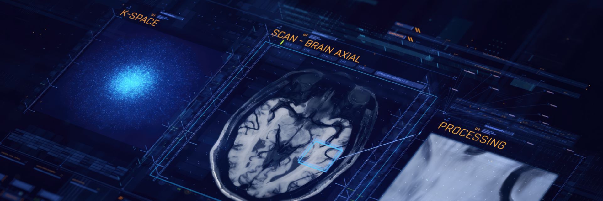 Radiologist sitting behind the MRI console looking at clinical images acquired with Compressed SENSE