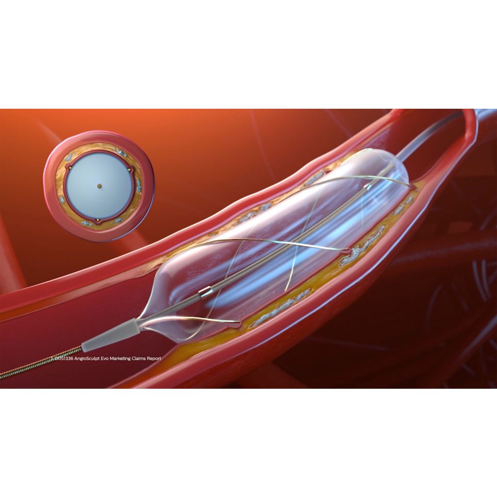 Strong safety profile