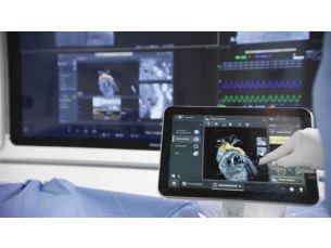 SmartCT Angio Technologie d’imagerie