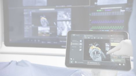 SmartCT Angio Imaging technology