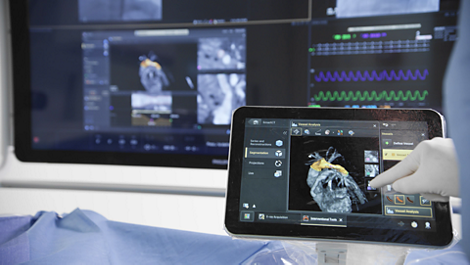SmartCT Angio Imaging technology