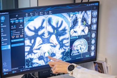 Philips MRI brain imaging for MRgFUS procedure
