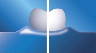 Tu sonrisa puede ser notablemente más blanca