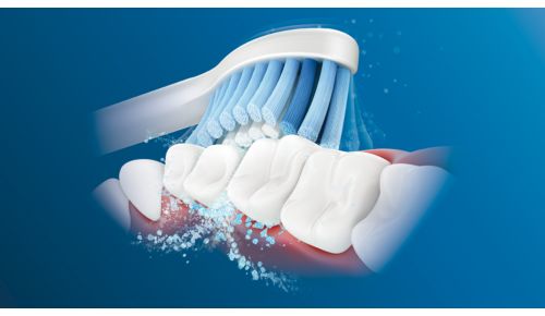 Philips Sonicare's advanced sonic technology