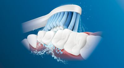 Philips Sonicare's advanced sonic technology
