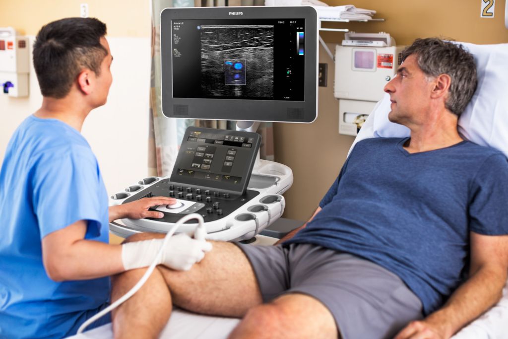 Ultrasound Leg scan with eL18-4 Transducer