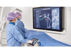 SmartCT Solución para la visualización y medición 3D