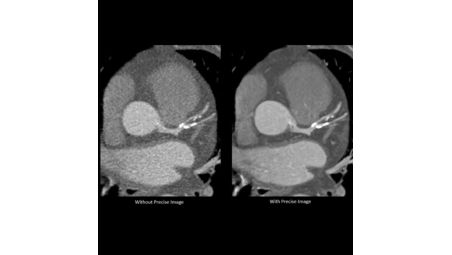 Advance your cardiac imaging capabilities