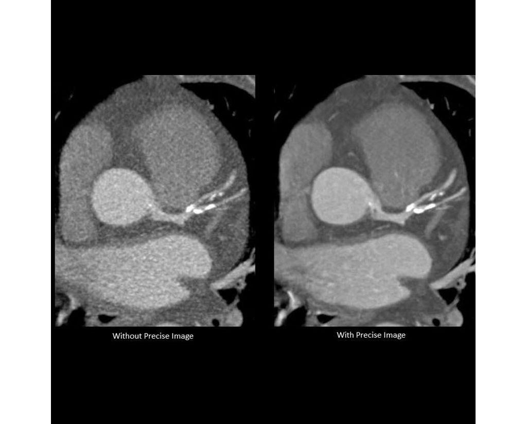 Advance your cardiac imaging capabilities