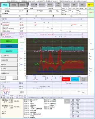 IntelliSpace 周術期監視画面インターフェース