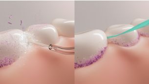 Up to 100% healthier gums vs. string floss**