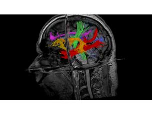 MultiBand SENSE MR clinical application