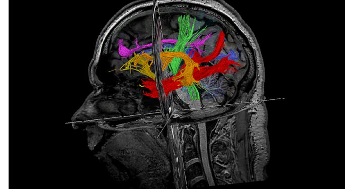 MultiBand SENSE  MR clinical application