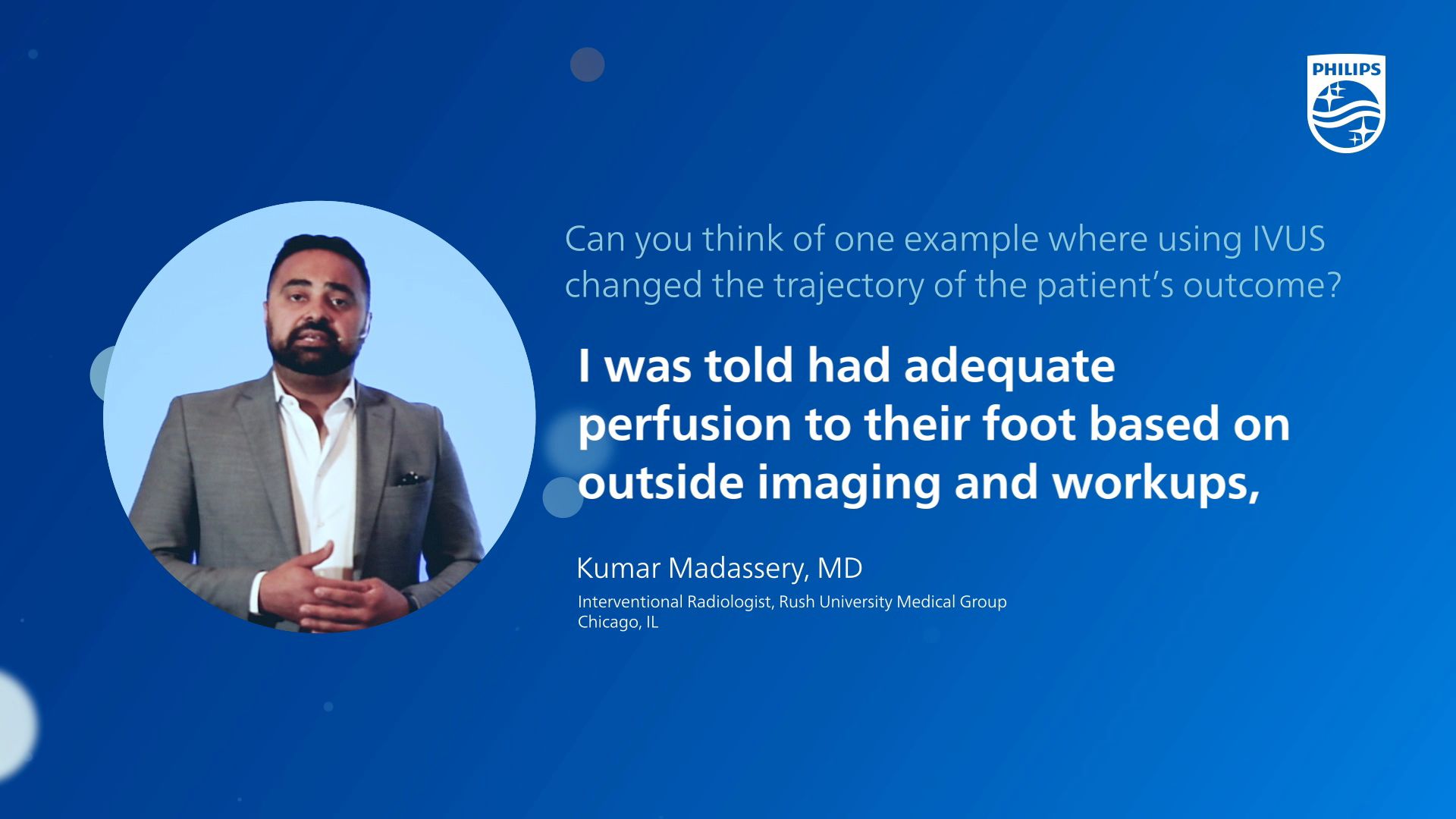 Kumar Madassery MD Peripheral IVUS testimonial