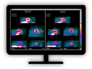 NM Emory Cardiac Toolbox (ECTb) Cardiac analysis