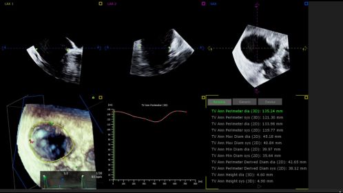 EPIQ CVx 3D Auto TV