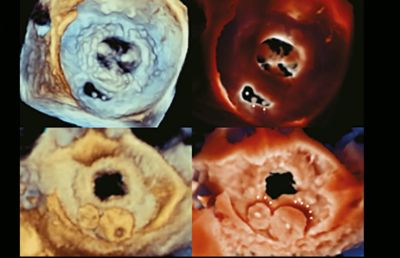 Live 3D TEE - EXPERTENKURS