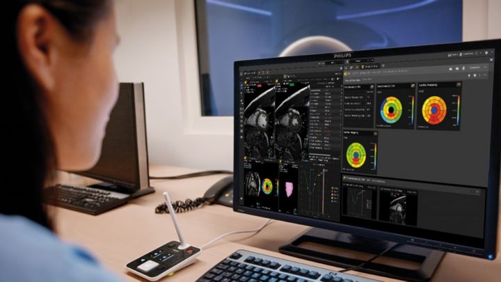 Visualisation avancée et analyse en imagerie radiologique